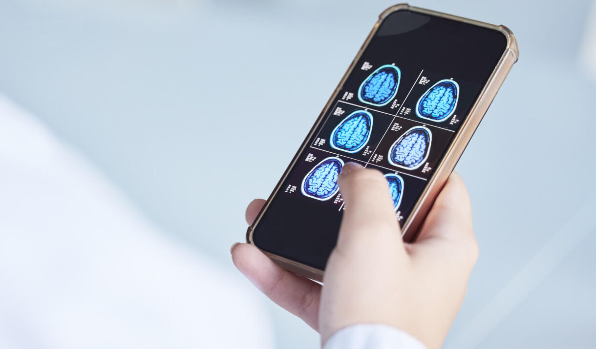 brain x ray clinic phone results and doctor hands 2023 11 27 05 09 23 utc (1) (1)